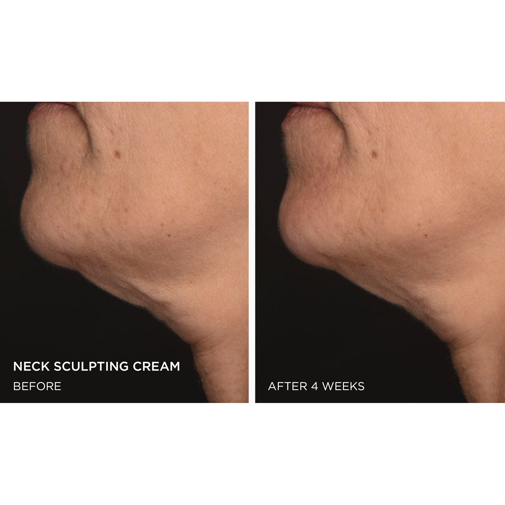 NNM Neck Sculpting Cream